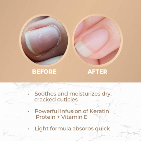Seche Condition Keratin-Infused Cuticle Oil [3]