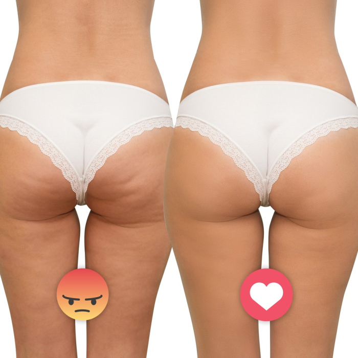 Aparat de masaj ultrasonic inSPORTline Valeri [4]