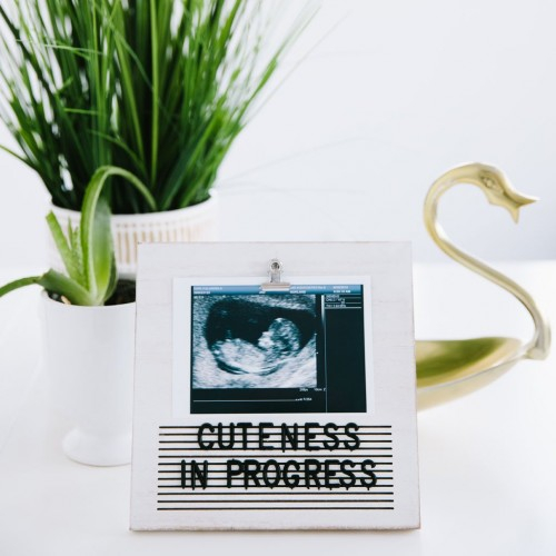 Rama foto ecografie cu litere pentru personalizare [7]