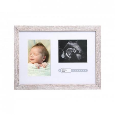 Cadouri baby shower - Rama foto pentru ecografie si bratara din maternitate