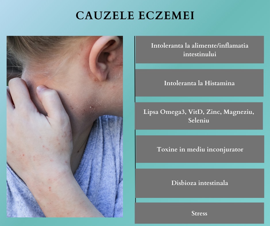 Eczema