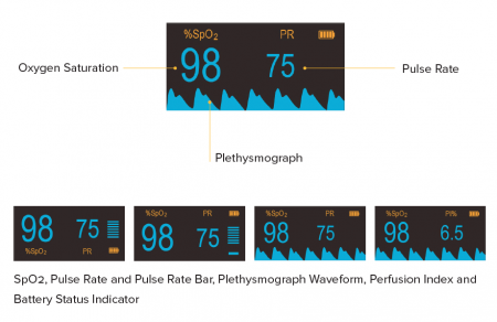 Pulsoximetru HbO-Smart, display OLED [1]