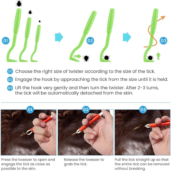 Kit pentru indepartarea capuselor, 7 piese, carlige, pensete, lupa, pieptene, carcasa depozitare [4]
