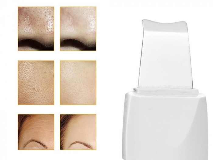 Aparat ingrijire faciala, lifting, curatare piele, cu 2 capete de silicon incluse - Alb [5]
