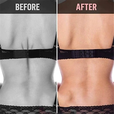 Extensie elastica pentru sutien 3x3 prinderi, 10x4 cm - Negru [3]