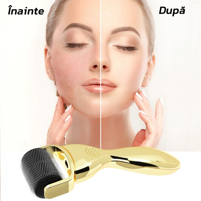 Rola Dermatologica 3 in 1 - Capete Detasabile, Masaj Facial, Regenerarea Pielii, 0,25/0,5/1,5 mm, Ace Titan, Auriu [2]