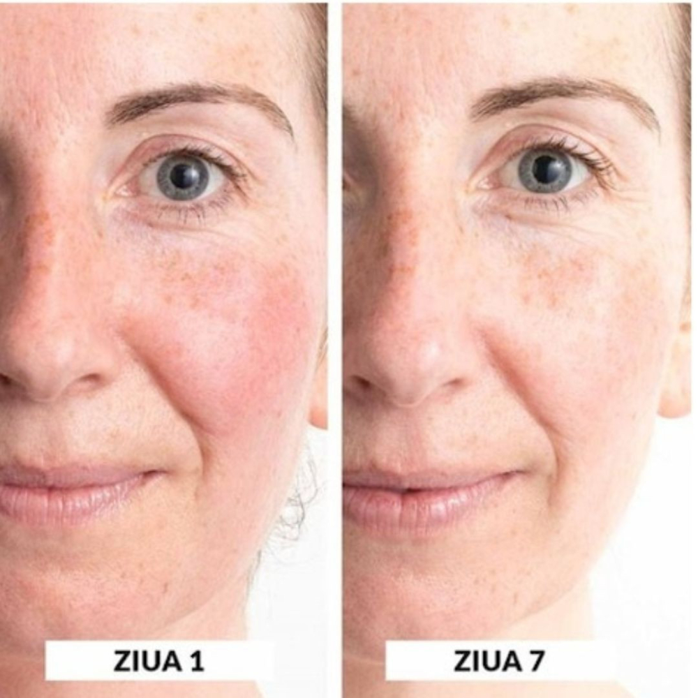 Set 2 produse pentru ingrijirea tenului Avon Anew Power Couple Serum & Eye Set – ser si crema pentru ochi, anti-imbatranire, tehnologie Protinol, pentru toate tipurile de ten – zi si noapte [4]