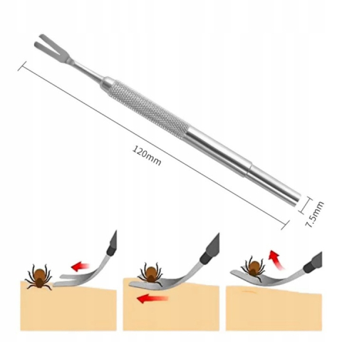 Unealta pentru indepartarea sigura a capuselor, metal, 12 cm, ideala pentru oameni si animale, argintiu [5]