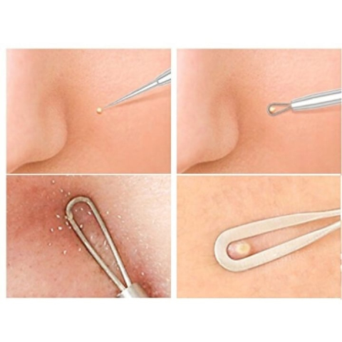 Trusa 7 instrumente din inox pentru cosmetica, extractia comedoanelor, punctelor negre si acneei, cu pouch de depozitare negru [8]