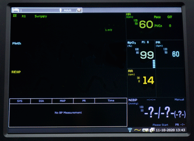 Monitor functii vitale uz veterinar Edan X12 VET [5]