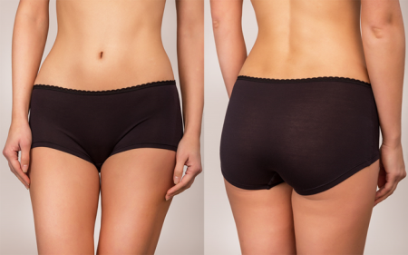 CHILOTI - Boxeri de dama din vascoza 595034