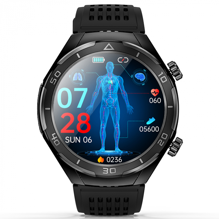 iSEN FD02 Smartwatch Black, 1.46 "HD, Sleep improvement, Blood glucose, PPG+ECG, HR, Bt call, SOS, Voice assist, Remote care [2]