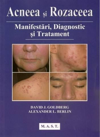 Medicina & Farmacie - Acneea si rozaceea de David J. Goldberg