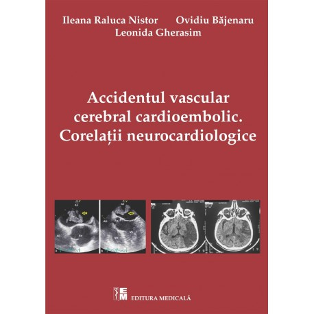 Accidentul vascular cerebral cardioembolic. Corelatii neurocardiologice - Ileana Raluca Nistor, Ovidiu Bajenaru, Leonida Gherasim [1]