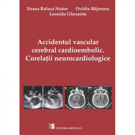 Medicină - Accidentul vascular cerebral cardioembolic. Corelatii neurocardiologice - Ileana Raluca Nistor, Ovidiu Bajenaru, Leonida Gherasim