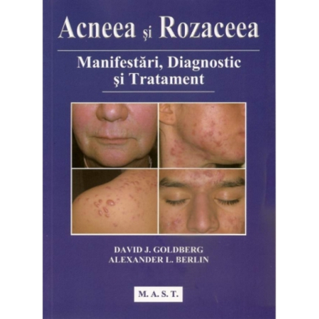 Medicină - Acneea si rozaceea. Manifestari, diagnostic si tratament - David J. Goldberg, Alexander L. Berlin