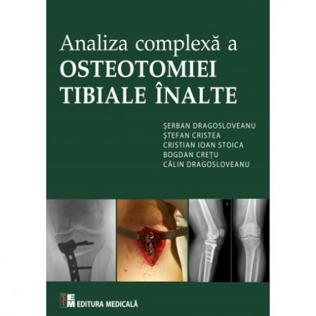 Medicină - Analiza complexa a osteotomiei tibiale inalte - Serban Dragosloveanu, Stefan Cristea, Cristian Ioan Stoica, Bogdan Cretu, Calin Dragosloveanu