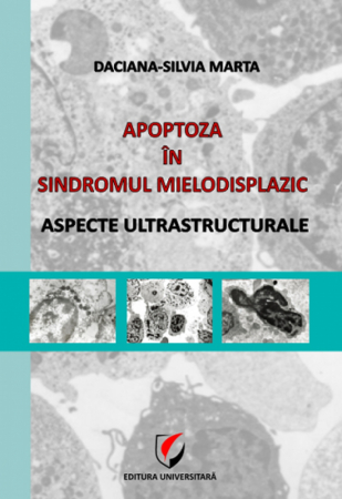Medicine - Apoptosis in mieolodisplazic syndrome