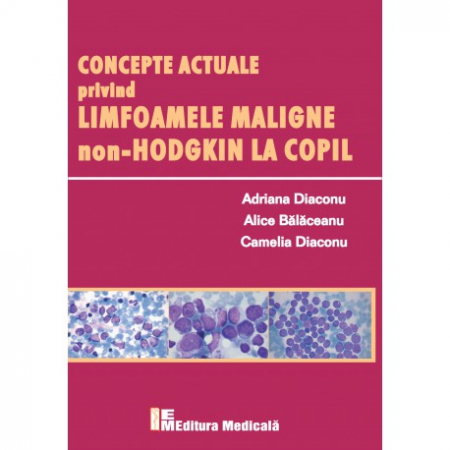 Medicină - Concepte actuale privind limfoamele maligne non-Hodgkin la copil - Adriana Diaconu, Alice Balaceanu, Camelia Diaconu
