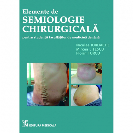 Medicină - Elemente de semiologie chirurgicala pentru studentii facultatilor de medicina dentara - Niculae Iordache, Mircea Litescu, Florin Turcu