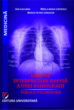 Medicine - Quick guide to interpreting a chest x-ray