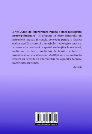 Quick guide to interpreting a chest x-ray [1]