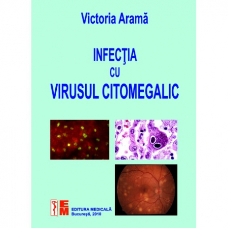 Medicină - Infectia cu virusul citomegalic - Victoria Arama