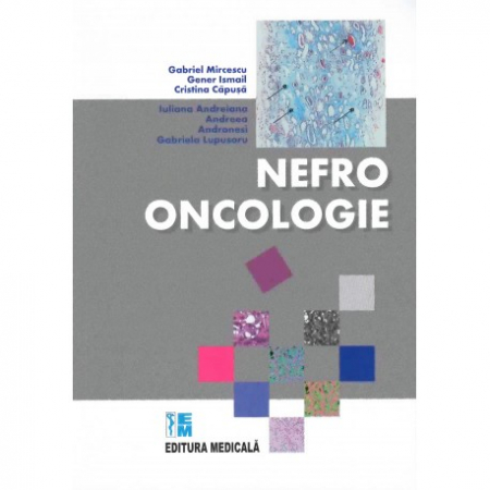 Medicină - Nefrooncologie - Gabriel Mircescu, Gener Ismail, Cristina Capusa, Iuliana Andreiana, Andreea Andronesu, Gabriela Lupusoru