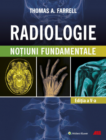 Medicină - Radiologie. Notiuni fundamentale. Editia a V-a - Thomas A. Farrell