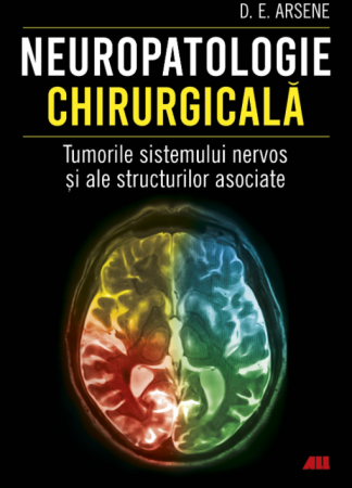 Medicine - Surgical neuropathology. Tumors of the nervous system and associated structures - Dr. Dorel Eugen Arsene
