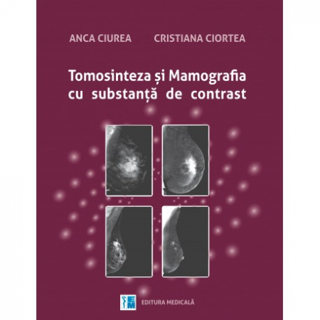 Medicină - Tomosinteza si mamografia cu substanta de contrast - Anca Ciurea, Cristiana Ciortea