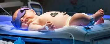 TL 20W/52 - Tratament icter neonatal (nou-nascuti) [3]