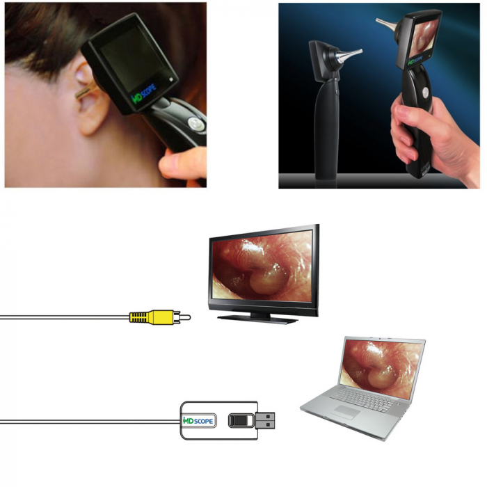 Video otoscop ORL MD Scope® Elite Pack [7]
