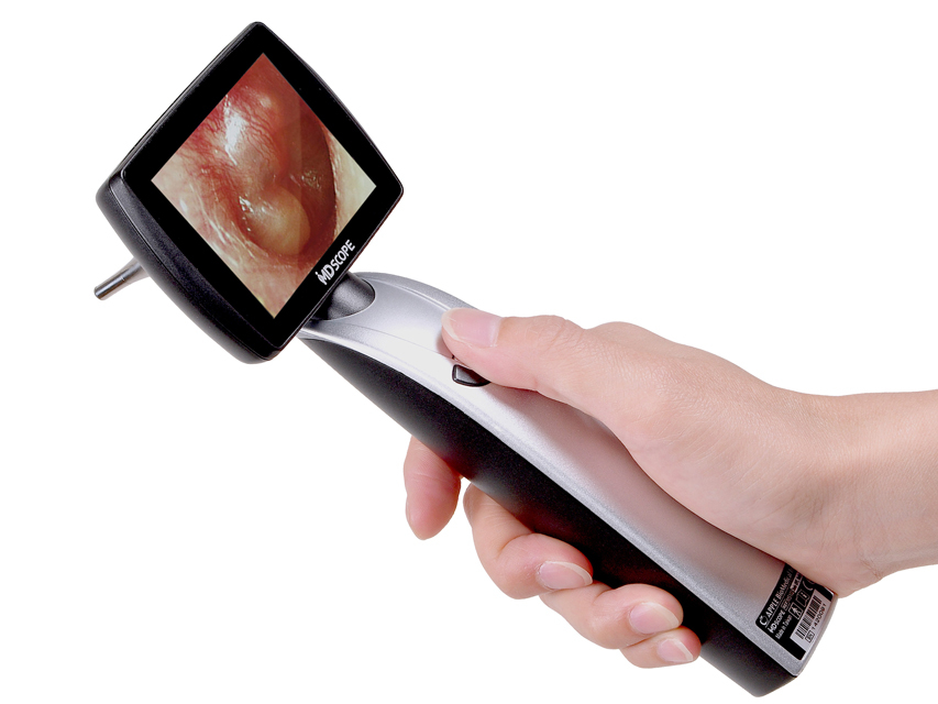 Video otoscop ORL MD Scope® Elite Pack [2]