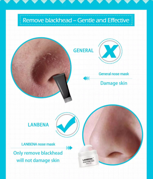 Masca pentru nas, tratament puncte negre, acnee [6]