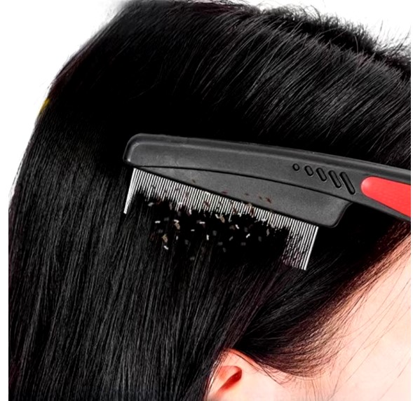 pieptene dermatita seboreica coji scalp