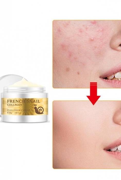 Crema multifunctionala reparatoare calmanta cu extract de melc, EVNC, Snail Collagen, 25 gr [2]