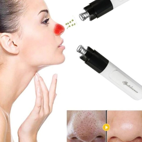 Aparat Vacuum SPOTCLEANER pentru Curățarea Porilor, CRM, Absorbția Punctelor Negre, Îngrijire Ten și Curățare Facială [5]