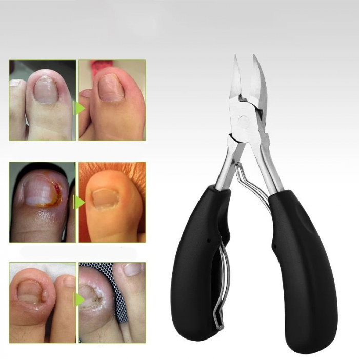 Cleste pedichiura, ADM, pentru unghiile incarnate sau groase, inox, negru/argintiu [2]