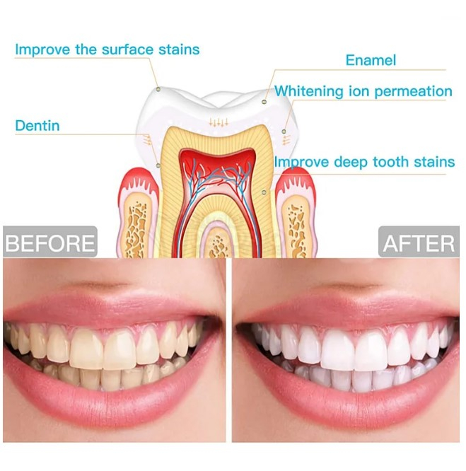 Transformă-ți zâmbetul cu Creionul pentru Albirea Dintilor GMO Bright Pearl! Formula sa inovatoare și portabilitatea sa îl fac perfect pentru un zâmbet strălucitor în orice moment și oriunde ai fi. Cu acest creion, obții rezultate profesionale de albire rapidă și eficientă, fără a fi nevoie de vizite costisitoare la dentist. Discret și ușor de utilizat, acest creion îți oferă un zâmbet mai alb și mai strălucitor, fără eforturi suplimentare. [4]