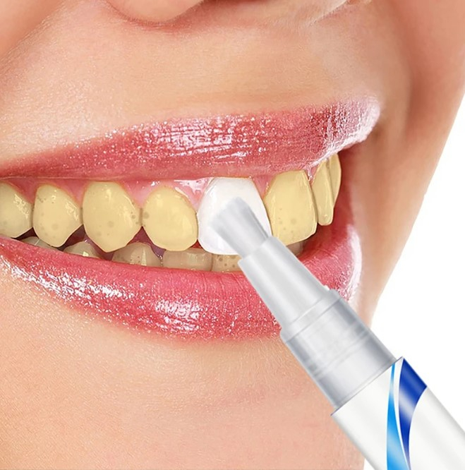 Transformă-ți zâmbetul cu Creionul pentru Albirea Dintilor GMO Bright Pearl! Formula sa inovatoare și portabilitatea sa îl fac perfect pentru un zâmbet strălucitor în orice moment și oriunde ai fi. Cu acest creion, obții rezultate profesionale de albire rapidă și eficientă, fără a fi nevoie de vizite costisitoare la dentist. Discret și ușor de utilizat, acest creion îți oferă un zâmbet mai alb și mai strălucitor, fără eforturi suplimentare. [5]