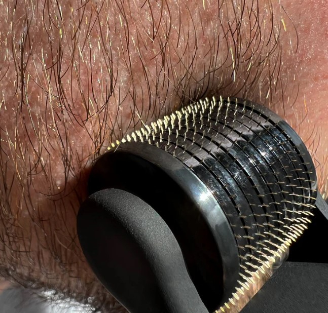 Derma-Roller pentru Creșterea Părului și Bărbii – Beard Roller 0.5mm [6]