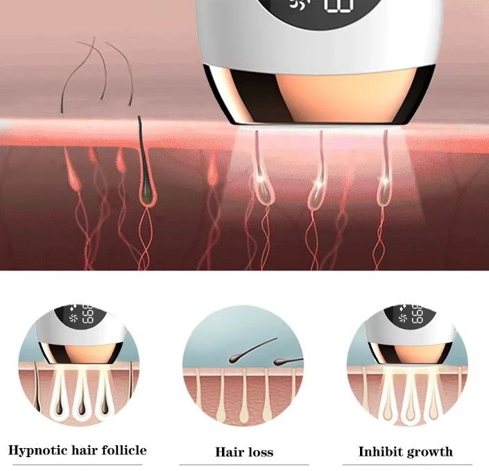 Epilator Laser Mijia pentru Femei, Îndepărtare Păr IPL Permanentă, Fără Durere, 999999 Flash-uri pentru Corp [5]