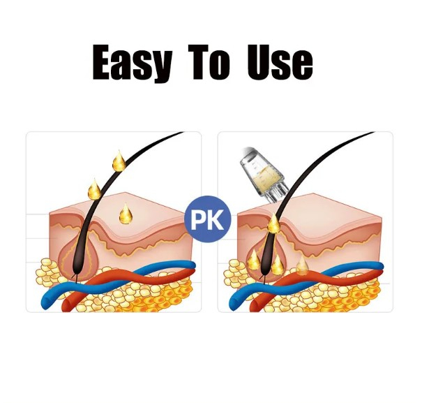 Instrument aplicare ulei pentru scalp EVNC – Essential Scalp Tool | Masaj și îngrijire [3]