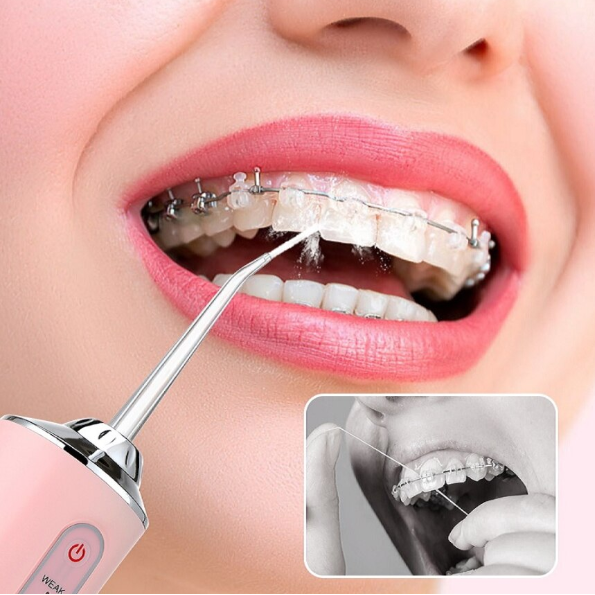 Irigator Oral/Dental, 3 Programe de Presiune, 4 Vârfuri Incluse, USB/IPX7, CRM, 220 ml, Portabil, Alb [2]