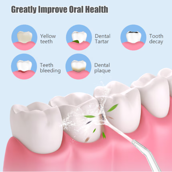 Irigator Oral/Dental, 3 Programe de Presiune, 4 Vârfuri Incluse, USB/IPX7, CRM, 220 ml, Portabil, Alb [8]