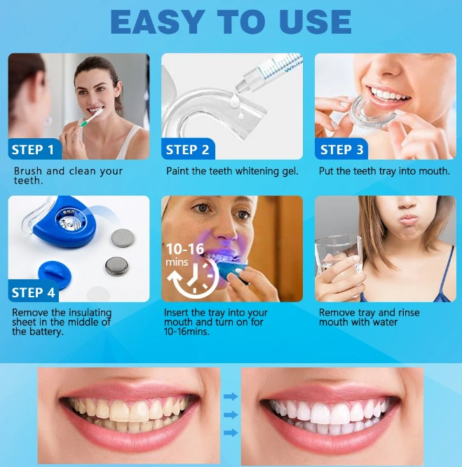 Kit profesional pentru albirea dintilor Smile Kit – Albire rapida acasa [3]