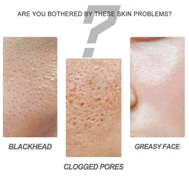 Masca faciala EELHOE cu carbune activ – Peel Off, puncte negre, acnee [5]