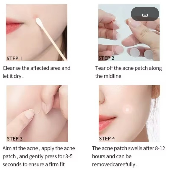 Plasturi invizibili anti-acnee Royal Prestige – Invisible Acne Patches | Tratament Eficient [2]