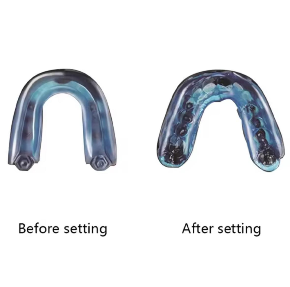 Protectie dentara premium pentru sport, ADM SportGuard, gutiera termoplastica ajustabila pentru box, MMA, baschet si sporturi de contact [4]